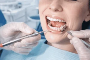 Veltrona blog post about the extraction in dentistry.